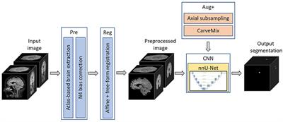 New lesion segmentation for multiple sclerosis brain images with imaging and lesion-aware augmentation